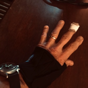 Lefty is having a rough summer but surprisingly I can still play. Mild wrist and trumb pain and more than mild finger cut pain. Should be more careful making veggie lasagna.